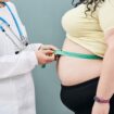 Obesity, unhealthy weight. Nutritionist inspecting a woman's waist using a meter tape to prescribe a weight loss diet