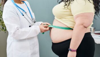 Obesity, unhealthy weight. Nutritionist inspecting a woman's waist using a meter tape to prescribe a weight loss diet