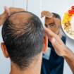 Hair growth could slow down with this popular diet plan, study reveals