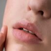 Labios cortados por el frío: cómo aliviar, hidratar y prevenir las grietas